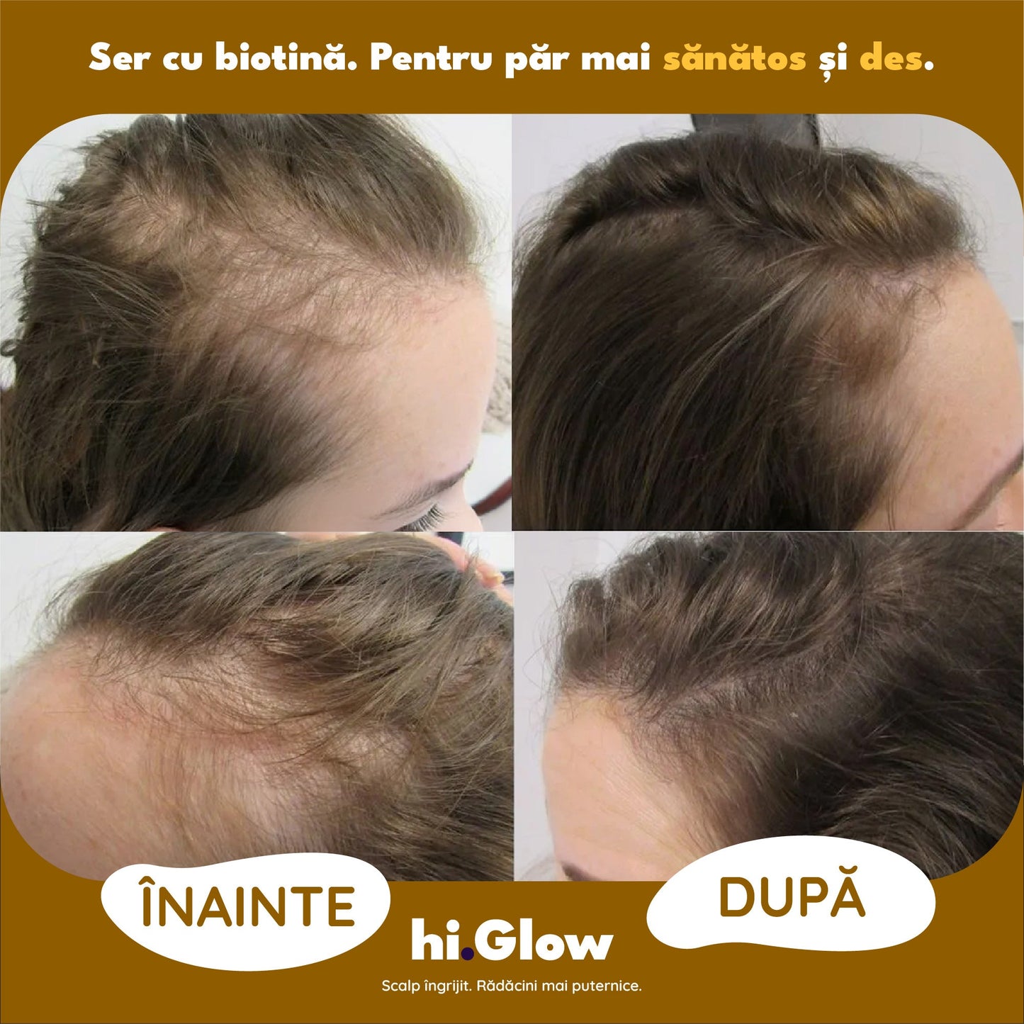 Ser pentru Creșterea Părului cu Biotină - hi.Glow